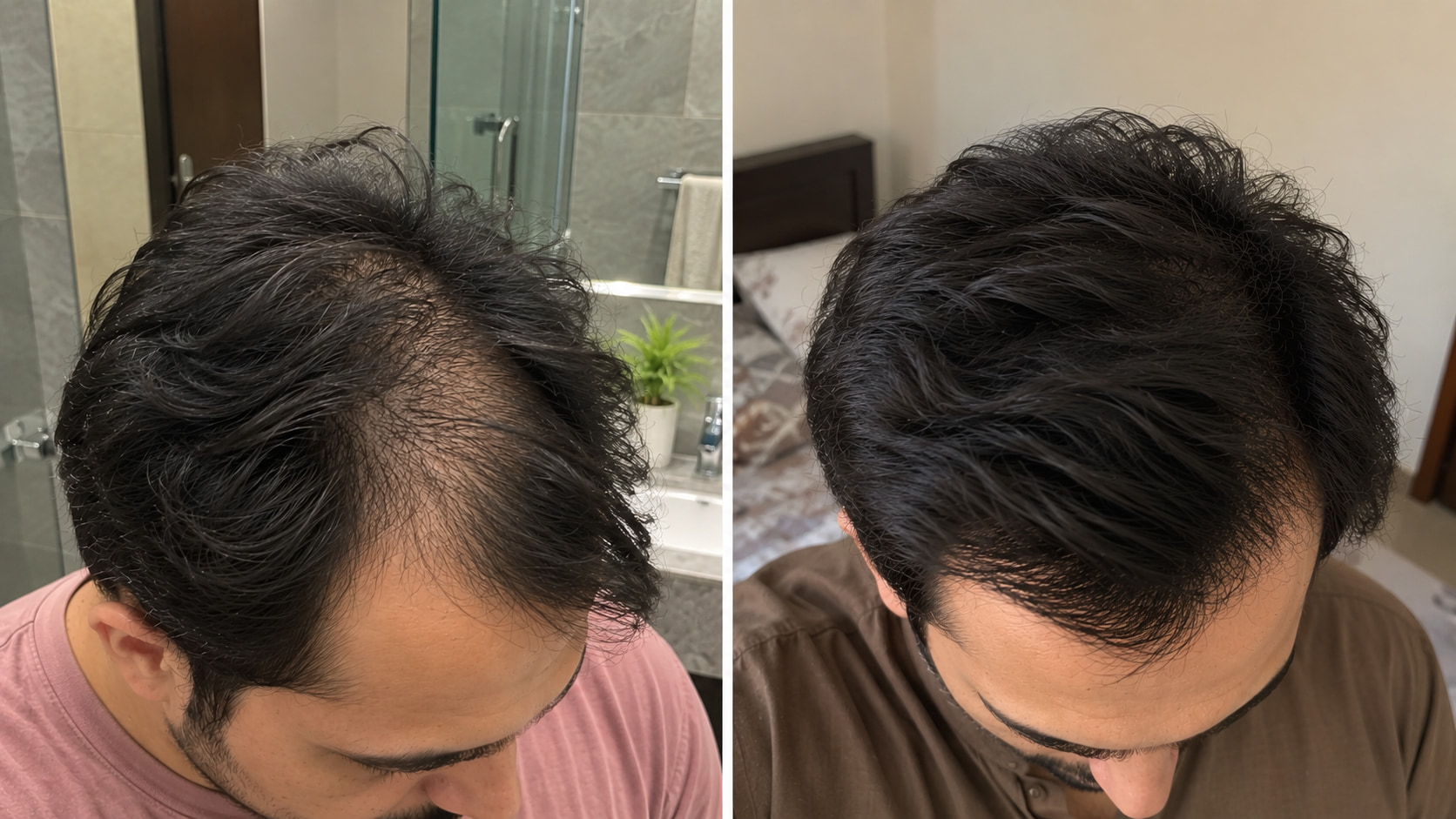 Real customer before and after hair results