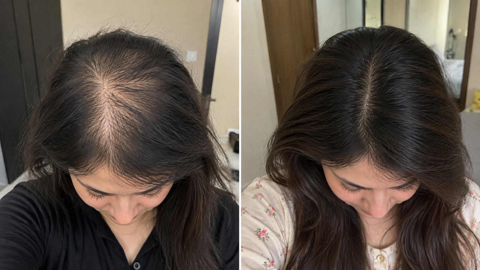 Real customer before and after hair results