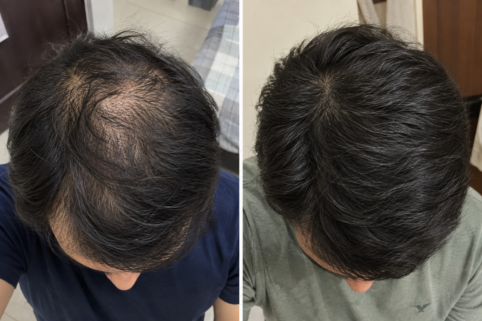 Real customer before and after hair results